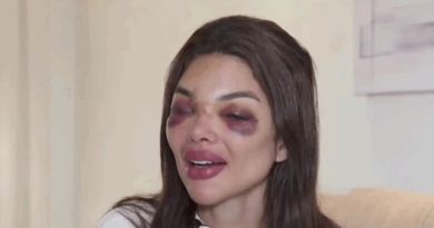 Empresário vira réu por lesão corporal após agredir a mulher em SP