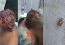 Tentativa de homicídio contra liderança comunitária expõe riscos à vigilância ambiental no rio Tapauá